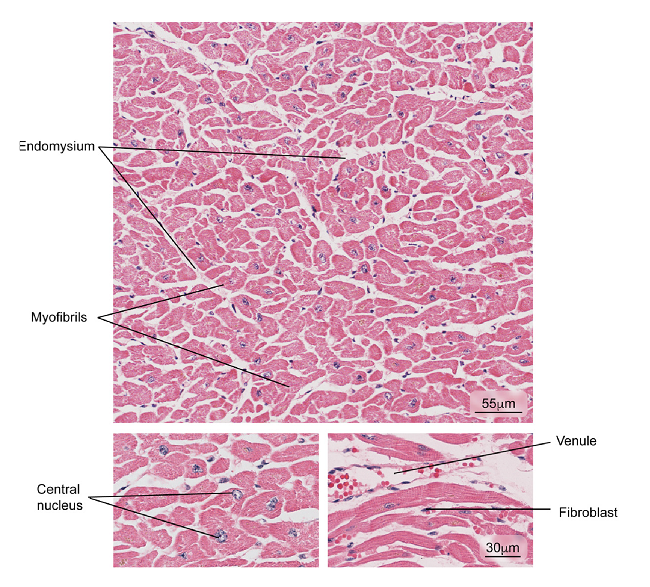 Aspect observed in patients with normal cardiac muscle tissue. The myocardium composed of cardiac muscle fibers, venules, and fibroblasts in the endomysium is observed. Hematoxylin and eosin stain.