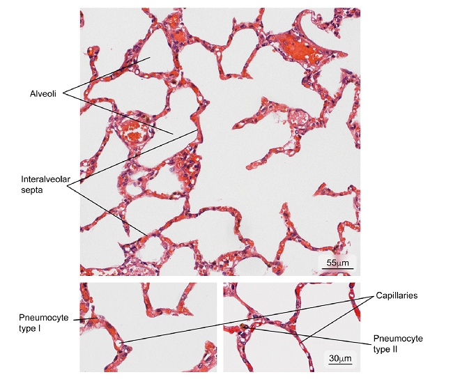 Normal lung tissue. Intrapulmonary structure with gaseous exchange (alveoli) and main cell types in the interalveolar septum (type I and II pneumocytes). Hematoxylin and eosin stain.