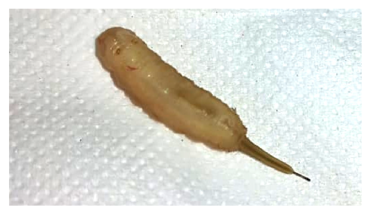 Larva de la mosca Eristalis tenax (larvas cola de rata) identificada en las heces del paciente. Nótese el cuerpo cilíndrico de color amarillo pardo y, en la parte posterior, una prolongación en forma de tubo delgado retráctil y móvil. Estas características ayudan a su identificación.
