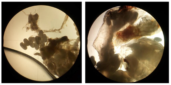 Restos de Tunga penetrans. Se observan el vientre y la cloaca del parásito, con presencia de huevos en el interior y exterior. Sin coloración, 4X.