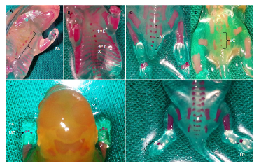 Alteraciones en la osificaci&oacute;n de estern&oacute;n, columna vertebral y extremidades. Sitios de osiicaci&oacute;n. A: Estern&oacute;n en feto del grupo control. Osiicaci&oacute;n completa de los seis centros del estern&oacute;n (E) y falanges anteriores (FA). B: Estern&oacute;n en feto del grupo diab&eacute;tico. Osiicaci&oacute;n parcial de la primera esternebra (1ra E), ausencia de la cuarta esternebra (4ta E) y ausencia del xifoides (X). C: V&eacute;rtebras caudales en feto del grupo control. Osiicaci&oacute;n completa de las v&eacute;rtebras caudales (VC). D: V&eacute;rtebras caudales en feto del grupo diab&eacute;tico. Ausencia de osiicaci&oacute;n de arcos en las v&eacute;rtebras caudales con osiicaci&oacute;n completa de tres centros de las v&eacute;rtebras caudales. E: Huesos de las patas anteriores en feto del grupo diab&eacute;tico. Ausencia de falanges anteriores (FA) y cuarto metacarpo (MC). F: Huesos de las patas posteriores en feto del grupo diab&eacute;tico. Ausencia de falanges posteriores (FP)