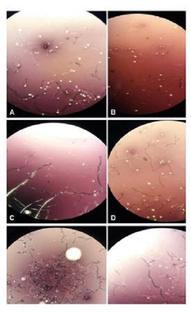 Microscopic images of sperm in NMRI mice treated with Cd and BE. A: Control; B: Cd; C: 200 µl of BE (1 g ml-1); D: 200 µl of BE (1 g ml-1) plus Cd (3 mg kg−1 of mouse body weight); E: 400 µl of BE (1 g ml-1); F: 400 µl of BE (3 g ml-1) plus Cd (1 mg kg−1). 4X