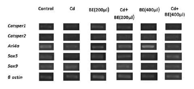 Relative gene expression determined by semi-quantitative RT-PCR. The expression of genes corresponds to the ratio of the target gene divided by the reference gene (β actin).