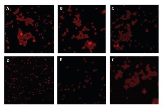 Confocal microscopy of viral complexes obtained from water samples in four potabilization plants in the department of Norte de Santander (Colombia) and their primary water sources (A: P1, B: P2, C: P3, D: P4; E, and F: Pamplonita River and Zulia River) with potential HAV content. The formation of aggregates can be observed in A, B, C, and F, while it is absent in D and E. Similar behavior was seen for Rotavirus.