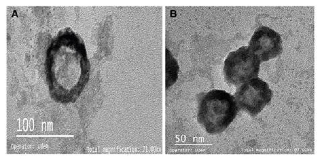 Captured and concentrated virions of A) Rotavirus and B) HAV observed by electron transmission microscopy