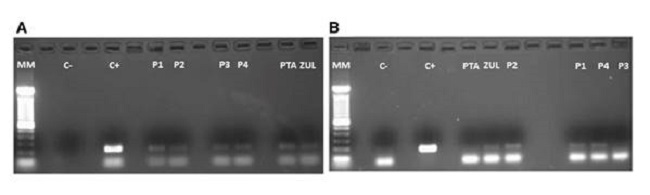 Agarose gel electrophoresis (1.8%) where C+ in A) shows the+211 bp-positive control corresponding to the VP6 gene that encodes the VP6 capsid protein while in B) C+ shows the 192 bp positive control corresponding to a fragment of the capsid protein precursor region which generates a unique intermediate (VP1-2A) of the HAV. The subsequent columns in both images show the analyzed water samples in the different treatment plants (P1-P4) and their primary water source (PTA: Pamplonita; ZUL: Zulia).