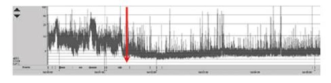 Monitoreo de la funci&oacute;n cerebral de un neonato con ciclo de sue&ntilde;o y vigilia, y aumento de la discontinuidad e inicio de actividad ictal de bajo voltaje (a partir de la flecha). El eje vertical representa el voltaje en uV y, el horizontal, el transcurso del tiempo. Olympic Brainz Monitor v3.1.5
