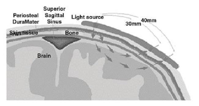 Fundamento fisiol&oacute;gico de la espectroscopia cerebral de infrarrojo cercano. Una fuente emite una luz que impacta los tejidos subyacentes y un detector mide el cambio de frecuencia de la misma luz reflejada. El prop&oacute;sito de esta espectroscopia es la medici&oacute;n de la saturaci&oacute;n de sangre venosa en las venas puente que atraviesan el espacio subaracnoideo