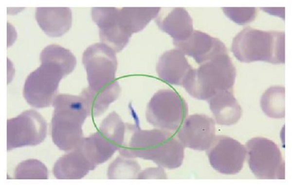 Extendido de sangre perif&eacute;rica, 40X. Se observan eritrocitos sin alteraci&oacute;n de la morfolog&iacute;a; no se observan leucocitos ni plaquetas. En la regi&oacute;n demarcada, se evidencia un tripomastigote.