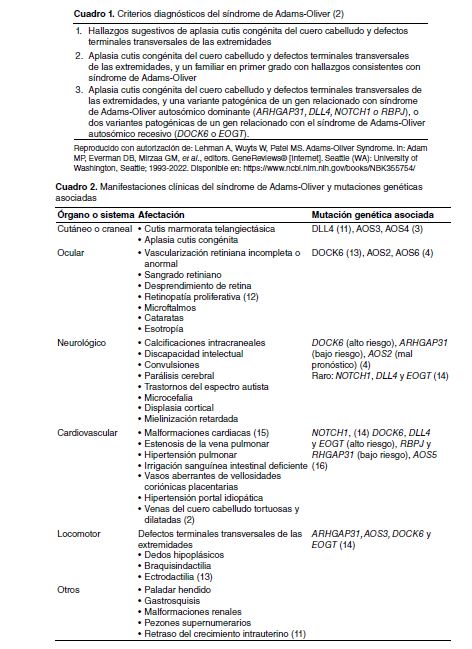 Criterios diagnósticos del síndrome de Adams-Oliver 2