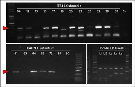 Electroforesis en geles de agarosa al 1,5 % de la PCR para Leishmania spp. (ITS1, panel superior). En los paneles inferiores, se observa, espec&iacute;ficamente, kADN de L. infantum (izquierda), as&iacute; como los perfiles de restricci&oacute;n de ITS1 con HaeIII para cepas de referencia de L. infantum (Li y Li2), L. colombiensis (Lc), L. braziliensis (Lb) y L. panamensis (Lp) (derecha).