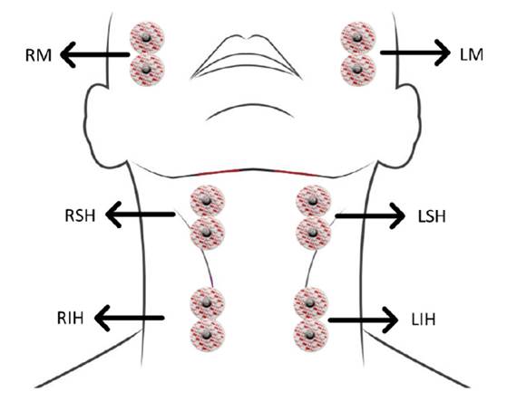 Posicionamiento de los electrodos superficiales sobre los grupos musculares de inter&eacute;s