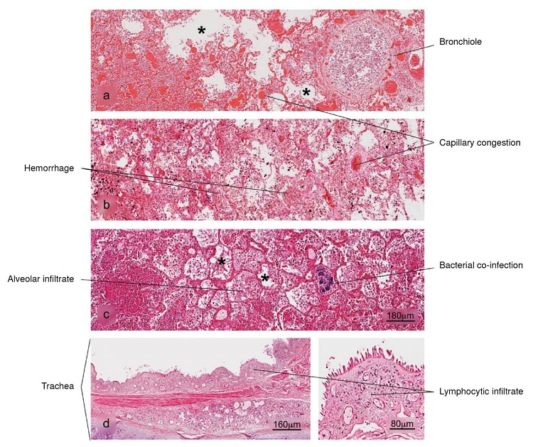 Histopathological alterations in lung tissue associated with COVID-19. a) bronchopneumonia, b) hemorrhage, c) superaggregated lobar pneumonia, d) inflammation of the trachea. Pulmonary alveolus (*). H&E stain.