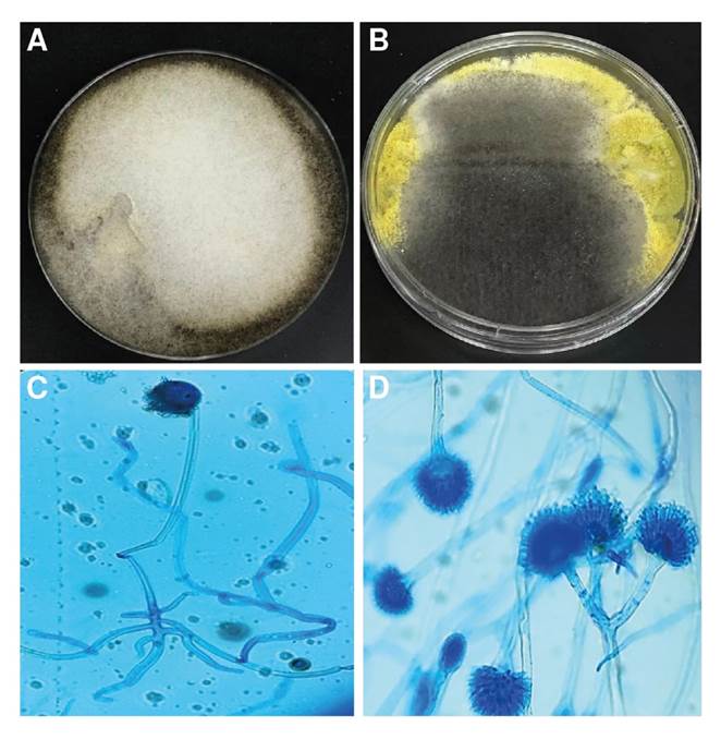 Crecimiento mixto de hongos filamentosos en agar Sabouraud. Colonia verde corresponde Aspergillus flavus/orizae y colonia gris Rizophus orizae (A) (B) Tinci&oacute;n de azul de lactofenol. Rhizopus oryzae (C) Aspergillus flavus (D) con objetivo de 40X.