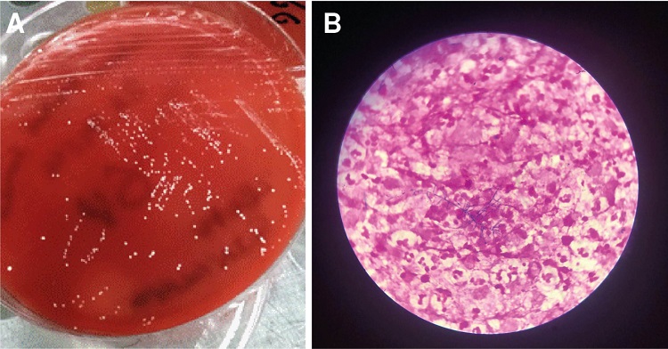 A. Colonias de Nocardia africana/nova en agar sangre. Muestra: absceso cerebral. B. Se observan estructuras bacterianas filamentosas Gram positivas. Tinci&oacute;n de Gram, 100X.