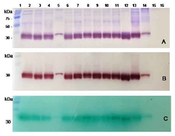 Non-reducing gel electrophoresis and zymographic analysis of protein extracts obtained from the culture media of clinical bacterial strains, reference strains, and the sterile culture medium (SCM). A. Coomassie Brilliant Blue for protein staining. B. Brown red a-naphthol-Fast Garnet GBC complex for SapS activity assessment, and C. Phosphate/green malachite/ ammonium molybdate complex for SapS phosphatase activity on O-phospho- L-tyrosine. Lanes from left to right: 1, pre-stained protein molecular weight; 2 13, clinical bacterial strains; 17, CPJ, 54 SL, 68 FFC, 69 GGT, 76 IQM, 88 VTM, 89-RTC, 92-HM, 93-EMC,101-AOC,105-IMO,107-FMR; 14, Stpphylococcus pureus ATCC-6538 strain; 15, Stpphylococcus epidermidis ATCC-12228; 16, SCM.