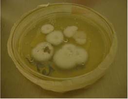 Cultivo de Histoplasma capsulatum en medio agar Sabouraud-dextrosa, a una temperatura de 28&deg;C