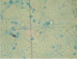 Macroconidias tuberculadas de Histoplasma capsulatum