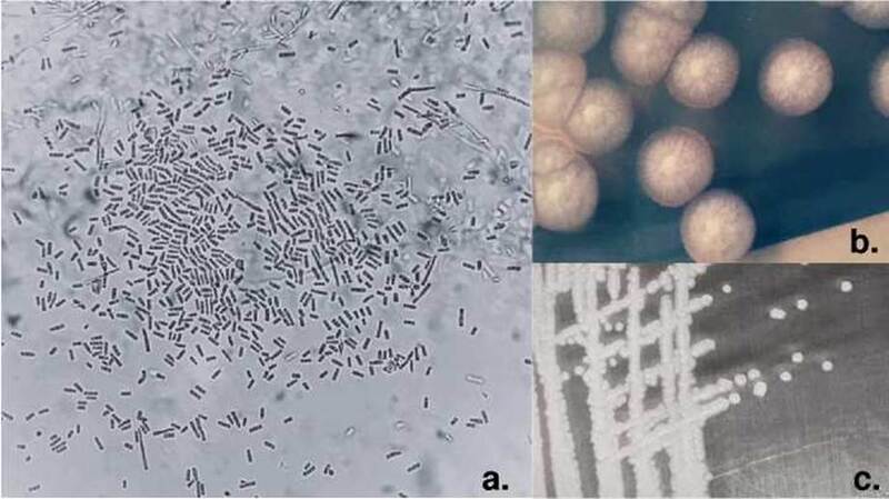 a. Hemocultivo de Geotrichum spp., se observan artroconidias hialinas rectangulares, Gram, 100X. b. En el cultivo se observa una colonia de aspecto algodonoso, de color blanco o crema. c. Colonias de Geotrichum spp. en agar Sabouraud.
