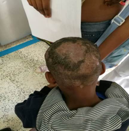 Ni&ntilde;o, caso &iacute;ndice