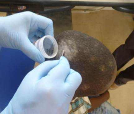 Recolecci&oacute;n de muestras