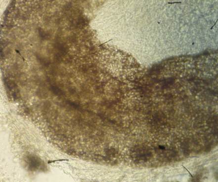 Parasitismo de tipo pilar, endotrix: las esporas y las hifas del hongo han invadido el interior de la estructura del pelo.