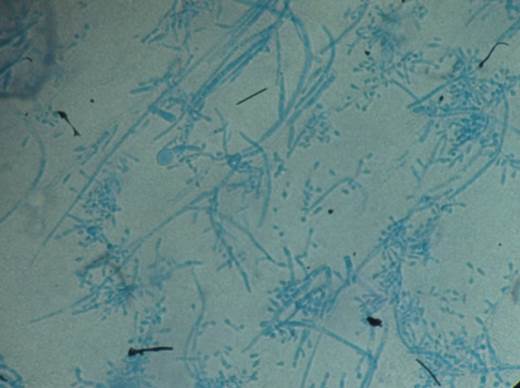 Montaje en azul de lactofenol: micromorfolog&iacute;a de Trichophiton tonsurans a partir del microcultivo