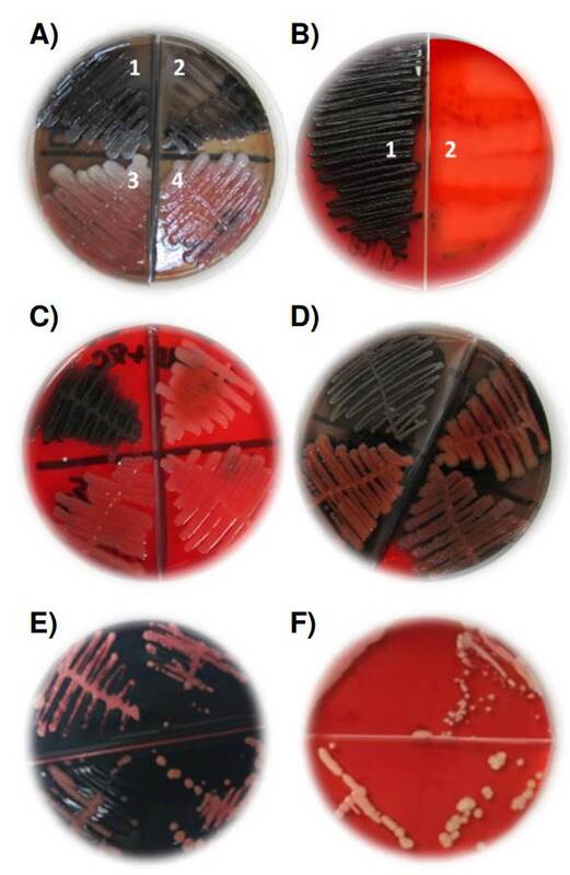 Presencia o ausencia de exopolisacáridos como indicadores de biopelículas, según el método de cultivo en agar con rojo Congo. A) Pseudomonas aeruginosa. Las cepas 1 y 2 fueron positivas y con precipitado de color negro, mientras que las cepas 3 y 4 fueron negativas y sin precipitado negro. B) Klebsiella pneumoniae. La cepa 1 fue positiva con precipitado negro y la cepa 2 fue negativa y sin precipitado negro. C) Staphylococcus aureus. La cepa 1 fue positiva y con precipitado negro, mientras que las cepas 2, 3 y 4 fueron negativas y sin precipitado negro. D) Estafilococos coagulasa negativa. La cepa 1 fue positiva y con precipitado negro, y las cepas 2, 3 y 4 fueron negativas y sin precipitado negro. E) Las cepas 1 y 2 de Candida albicans, la cepa 3 de C. tropicalis y la cepa 4 de C. parapsilosis, positivas y con color rosado intenso a fucsia. F) Las cepas 1 y 2 de C. albicans, la cepa 3 de C. tropicalis y la cepa 4 de C. parapsilosis, fueron negativas y con color blanco crema.