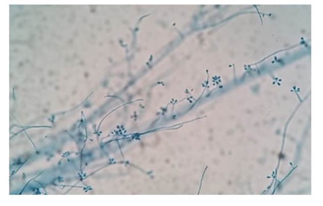 Microcultivo a 28 °C de Sporothrix spp., obtenido en cultivo primario. Azul de lactofenol, 400X.