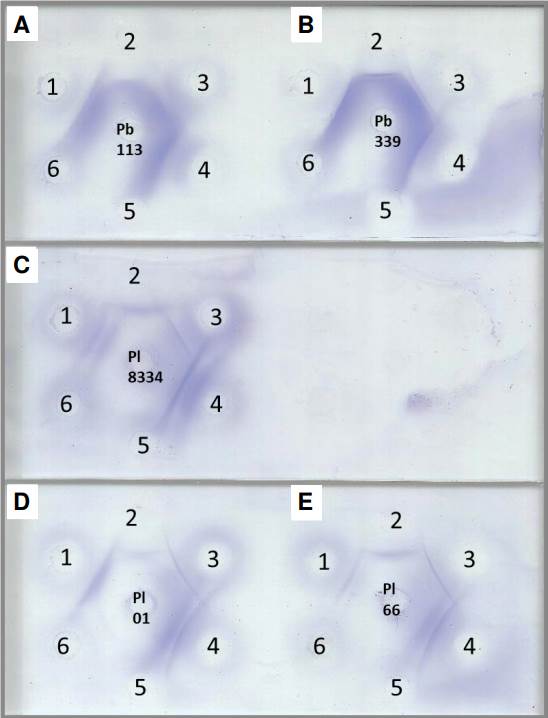 Double immunodiffusion assay with different Paracoccidioides spp. antigens. A) Th 113 7d 10X, B) Th 339 7d 10X, C) Th 8334 10d 20X, D) Th 01 20d 10X, and E) Th 66 5d 20X. 1) Anti-P. lutzii polyclonal antibody, 2) anti-P. brasiliensis polyclonal antibody, 3 and 4) paracoccidioidomycosis serum samples, 5) anti-H. capsulatum polyclonal antibody, and 6) anti-A. fumigatus polyclonal antibody.