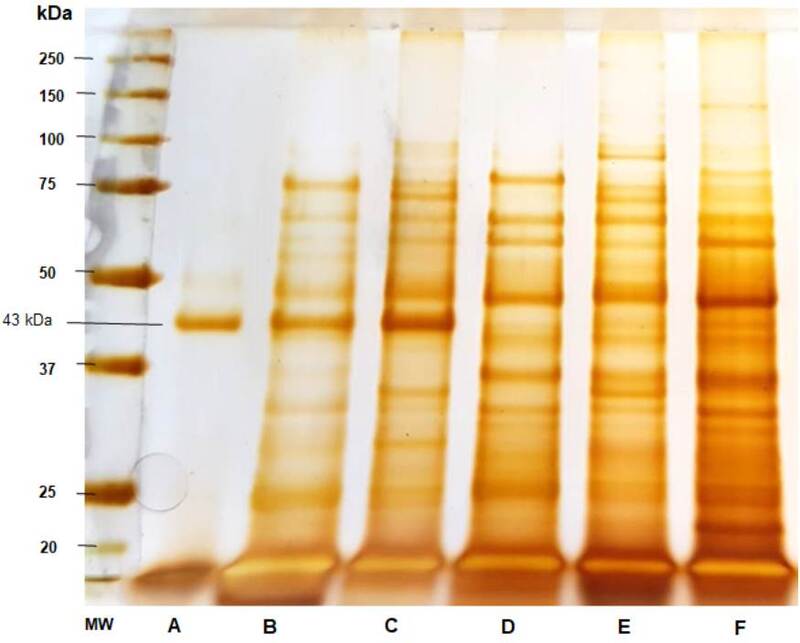 Sodium dodecyl sulfate-polyacrylamide gel electrophoresis (SDS-PAGE) of the Paracoccidioides spp. antigens. A) Paracoccidioides brasiliensis 113 culture-filtrate, B) Thimerosal 113 7d 10X, C) thimerosal B-339 7d 10X, D) Thimerosal 01 20d 10X, E) Thimerosal 66 5d 20X, and F) Thimerosal 8334 10d 20X.