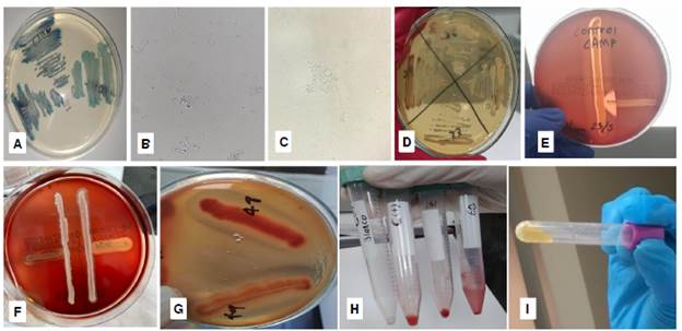 a. Tonalidades de verde en CHROMagar&trade; Candida, b. Imagen de tubos germinales, 400X. c. Producci&oacute;n de clamidoconidias, 400X. d. Colonia caf&eacute; (izquierda) en agar romero. e. Control positivo de la prueba de Christie, Atkins y Munch-Peterson (CAMP) en medio agar con sangre comercial. f. Prueba CAMP negativa en dos aislamientos de Candida (l&iacute;neas verticales). g. Hem&oacute;lisis generada por dos aislamientos de Candida en agar papa dextrosa y sangre, con suplemento de glucosa. h. Controles (negativo y positivo) y resultados positivos de formaci&oacute;n de biopel&iacute;culas (d&eacute;bil/fuerte), con 10% de safranina, en dos aislamientos. i. Prueba positiva para coagulasa.