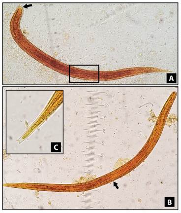 Strongyloides stercoralis larvae, stained with lugol solution, 400X. A) Rhabditform larvae showing a visible genital primordium (square) and short buccal canal (arrow). B) Filariform larvae displaying the union of the esophagus and the intestine in the middle of the larva (ratio 1:1). C) Filariform larvae with a detailed terminal part showing a notched tail