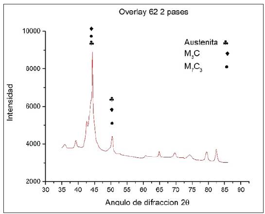 Difractograma obtenido de la superficie obtenida con electrodo Overlay 62® con dos capas para carburos del tipo M7 C23 y Fe7 C3