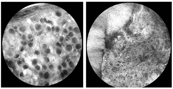 Determinaci&oacute;n de sexo gonadal mediante microscop&iacute;a &oacute;ptica. a. Observaci&oacute;n de ovocitos en hembras a 10X. b. Obser vaci&oacute;n de tejido testicular en machos a 10X.