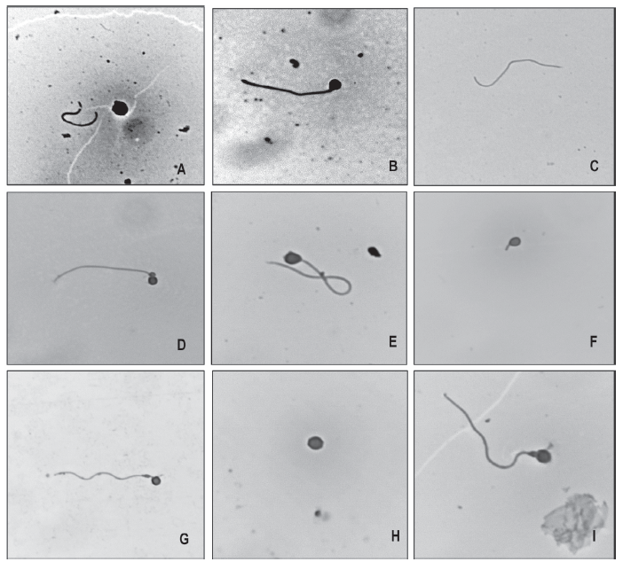 Anormalidades morfológicas en semen descongelado de cachama negra (Colossoma macropomum). A: cola rota, B macro cefalia, C cola separada, D gota citoplasmática, E cola doblada, F cola corta, G cola en espiral, H cabeza separada y I degenera ción pieza media. Magnificación 1000x.