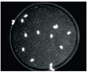 Espermatozoides unidos a la zona pelúcida.
