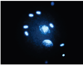 Ovocito fertilizado con presencia de dos pronúcleos.