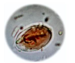 Microfotografía a 40X de quiste de Giardia duodenalis