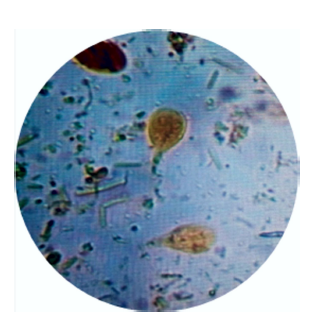 Microfotografía a 40 X de trofozoíto de Giardia duodenalis