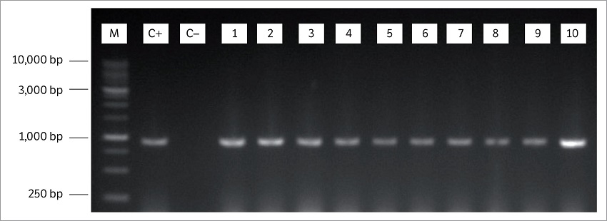 Electrophoresis in agarose gel of amplification products with specific primers for Curvularia lunata. M: Molecular marker of 1Kb; C+: Positive control; C-: Negative control (Fusarium verticillioides); 1: Araguacema; 2: Aragua&iacute;na; 3: Brejinho de Nazar&eacute;; 4: Caseara; 5: Gurupi; 6: Lagoa da Confus&atilde;o; 7: Marian&oacute;polis; 8: Palmas; 9: Sucupira; 10: Santa Maria das Barreiras.