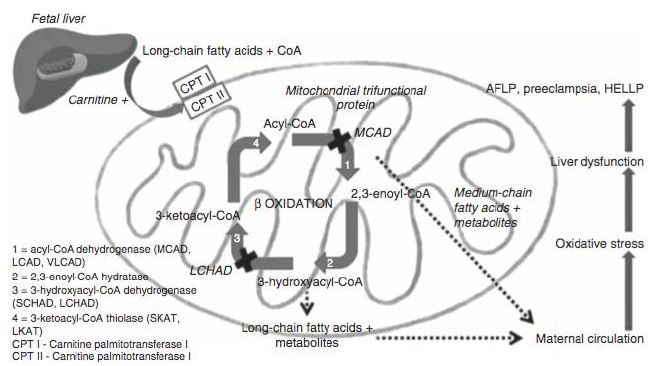 Fisiopatolog&iacute;a h&iacute;gado graso agudo del embarazo 