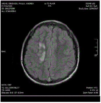 Resonancia magn&eacute;tica cerebral 