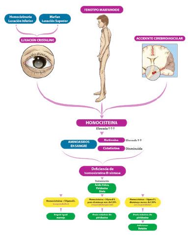 Aproximaci&oacute;n diagn&oacute;stica y manejo de la homocistinuria