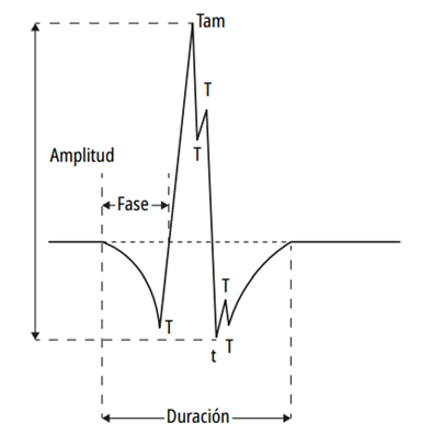 Forma del potencial de acci&oacute;n de unidad motora 6