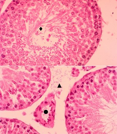 Micrografia del testculo del grupo control. Tbulos seminferos normales con coloracin de hematoxilina eosina (♦), sin incremento de tejido conjuntivo (▲), vasos sanguneos sin congestin vascular (●) (H/E) 40x.