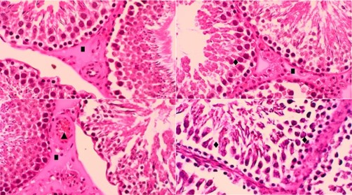 Micrografia del testculo de ratas tratadas con meloxicam. Incremento de tejido conjuntivo intersticial (∎), congestin vascular intersticial (▲), dao severo en las clulas germinales de la pared del tubo seminfero (♦) (H/E) 40x.