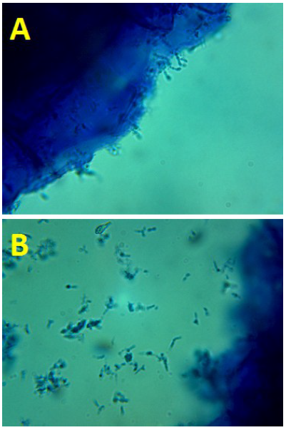 Fotografía bajo el microscopio óptico de campo claro y tinción con azul de metileno de microorganismos liberados de un nódulo de raíz de Vicia faba, responsables de la fijación de nitrógeno atmosférico. (A) Microorganismos en las inmediaciones de células de la raíz. (B) Bacterias en suspensión.