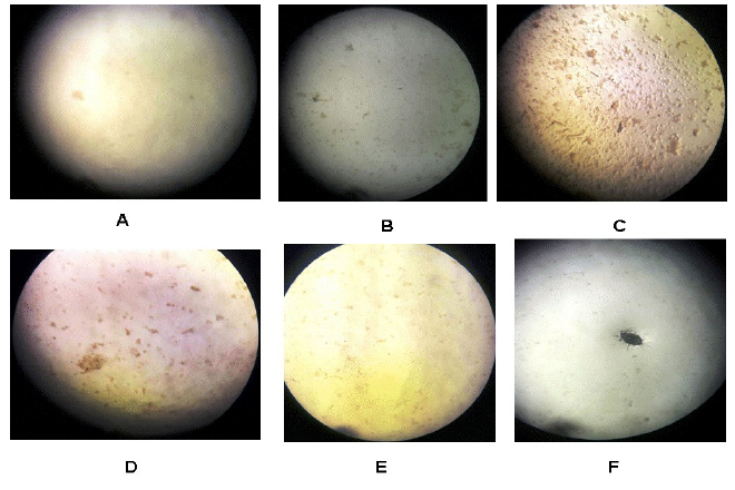 Desarrollo de biopel&iacute;culas en la primera semana
de incubaci&oacute;n. A) con filtro azul, B) con filtro verde, C) con filtro amarillo,
D) con filtro rojo, E) sin filtro (control 1), y F) envuelto en tela oscura
(control 2). Todas las fotos a un aumento de 400x
(objetivo 40x y ocular a 10x).