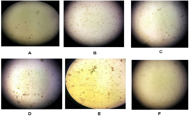 Desarrollo de biopel&iacute;culas en la segunda
semana de incubaci&oacute;n. A) con filtro azul, B) con
filtro verde, C) con filtro amarillo, D) con filtro rojo, E) sin filtro
(control 1), y F) envuelto en tela oscura (control 2). Todas las fotos a un
aumento de 400x (objetivo 40x y ocular a 10x).